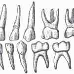 Gray1004 Zahnschema